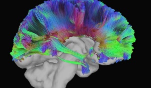 Zoom image: Brain's Blueprint: Mapping the Brain's Connectivity Using Tractography. (Credit: Elizabeth Castro) 